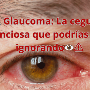 Comprendiendo el Glaucoma: Causas, Síntomas, Tipos y Tratamientos